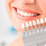 Consigue el Mejor Blanqueamiento Dental en Clínica Juan Gil